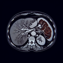 МРТ печінки