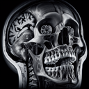 МРТ скронево-нижньощелепного суглоба